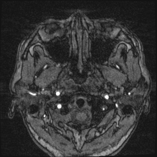 Click on the Serie image to view the images of VILLANUEVA, WILLIAM A.